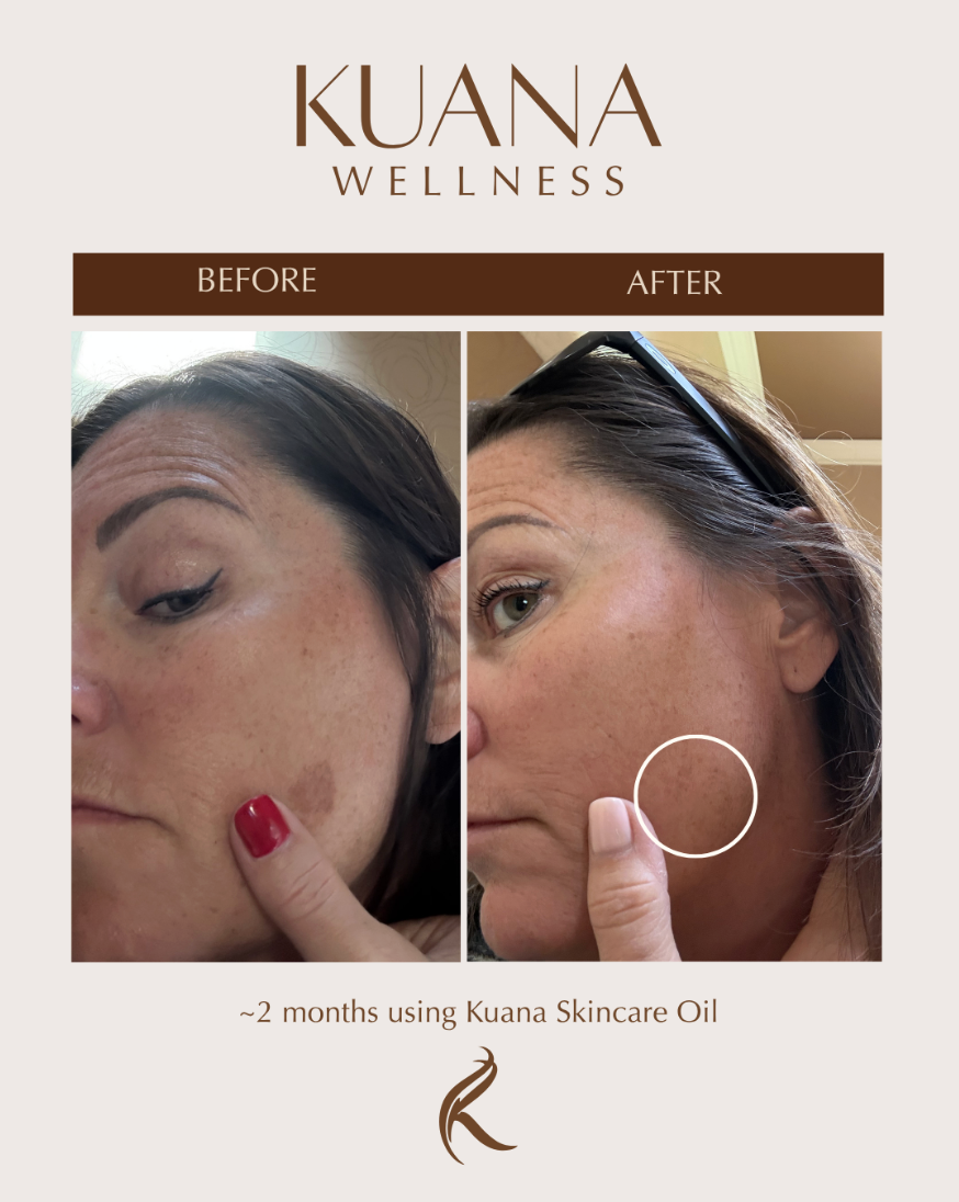 Kuana Skincare Oil
